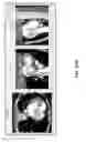Fig. 28 - Body structure imaging