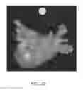 Fig. 42 - Body structure imaging