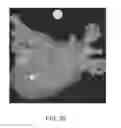 Fig. 44 - Body structure imaging