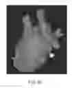 Fig. 45 - Body structure imaging