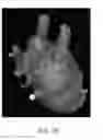 Fig. 48 - Body structure imaging