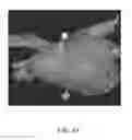 Fig. 52 - Body structure imaging