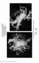 Fig. 57 - Body structure imaging