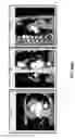 Fig. 59 - Body structure imaging