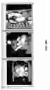 Fig. 60 - Body structure imaging
