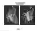 Fig. 61 - Body structure imaging