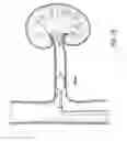 Fig. 17 - METHODS AND DEVICES FOR DETECTING NERVE ACTIVITY