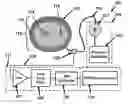 Fig. 01 - Assessing endothelial function using a blood pressure cuff