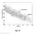 Fig. 17 - Assessing endothelial function using a blood pressure cuff