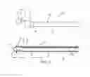 Fig. 03 - Pressure measuring catheter having reduced error from bending stresses