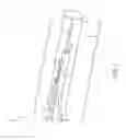 Fig. 02 - Physiological sensor delivery device and method