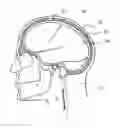 Fig. 01 - Apparatus and methods for detecting increase in intracranial pressure