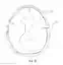 Fig. 04 - Apparatus and methods for detecting increase in intracranial pressure