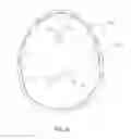 Fig. 05 - Apparatus and methods for detecting increase in intracranial pressure
