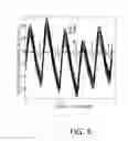 Fig. 08 - Apparatus and methods for detecting increase in intracranial pressure