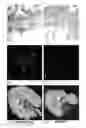 Fig. 03 - MRI-based systems and methods for determining function capacity of the kidney