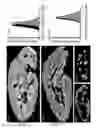 Fig. 04 - MRI-based systems and methods for determining function capacity of the kidney