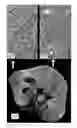 Fig. 05 - MRI-based systems and methods for determining function capacity of the kidney
