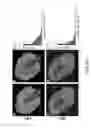 Fig. 07 - MRI-based systems and methods for determining function capacity of the kidney