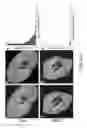 Fig. 08 - MRI-based systems and methods for determining function capacity of the kidney