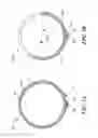 Fig. 04 - Supporting catheter for use for phrenic nerve pacing
