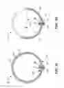 Fig. 05 - Supporting catheter for use for phrenic nerve pacing