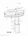 Fig. 07 - Supporting catheter for use for phrenic nerve pacing