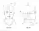 Fig. 06 - Systems and methods of automated dose control in x-ray imaging