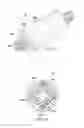 Fig. 06 - DESIGN AND METHOD FOR INTRAVASCULAR CATHETER