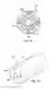 Fig. 07 - DESIGN AND METHOD FOR INTRAVASCULAR CATHETER