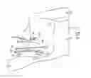 Fig. 07 - Sensor attachment for three dimensional mapping display systems for diagnostic ultrasound machines