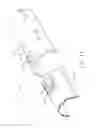 Fig. 12 - Surgical device for the collection of soft tissue
