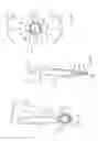 Fig. 05 - Minimally open retraction device
