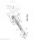 Fig. 09 - Minimally invasive surgical suturing device for papillary muscles and methods thereof