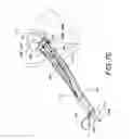 Fig. 11 - Minimally invasive surgical suturing device for papillary muscles and methods thereof