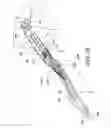 Fig. 13 - Minimally invasive surgical suturing device for papillary muscles and methods thereof