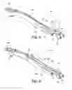 Fig. 18 - Minimally invasive surgical suturing device for papillary muscles and methods thereof