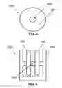 Fig. 05 - Suture for soft tissue repair