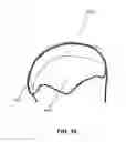 Fig. 11 - Suture for soft tissue repair