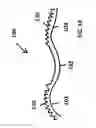 Fig. 19 - Suture for soft tissue repair