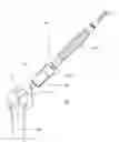 Fig. 04 - Instrument for the removal of a bone insert and corresponding method