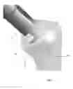 Fig. 08 - Instrument for the removal of a bone insert and corresponding method