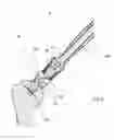 Fig. 09 - Instrument for the removal of a bone insert and corresponding method