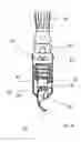 Fig. 10 - Instrument for the removal of a bone insert and corresponding method