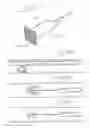 Fig. 13 - Endoscopic stone-extraction device