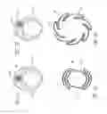 Fig. 03 - Systems and methods for removing obstructive matter from body lumens and treating vascular defects