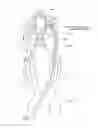 Fig. 06 - Systems and methods for removing obstructive matter from body lumens and treating vascular defects