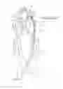 Fig. 07 - Systems and methods for removing obstructive matter from body lumens and treating vascular defects