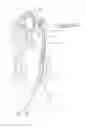 Fig. 08 - Systems and methods for removing obstructive matter from body lumens and treating vascular defects