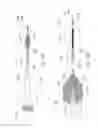Fig. 10 - Systems and methods for removing obstructive matter from body lumens and treating vascular defects